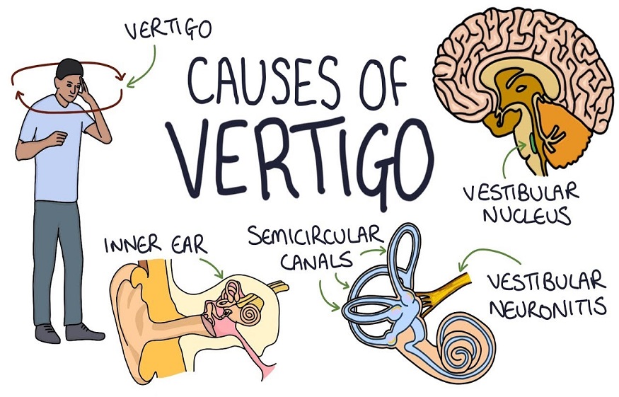 Causes And Treatments Of Vertigo