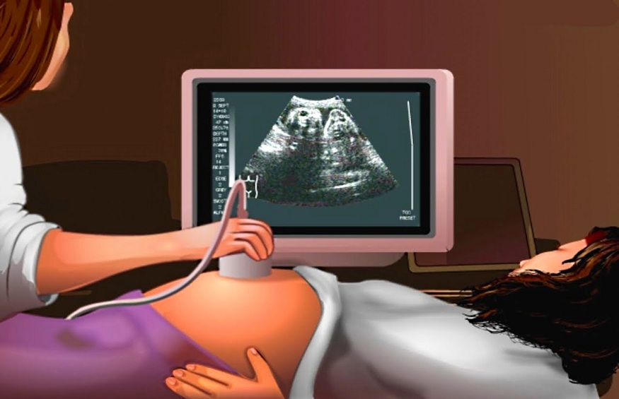 ultrasound san antonio
