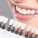 Choosing the Right Cosmetic Dentist for Your Smile Makeover