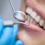 5 Key Signs That You Need to Visit a Dentist