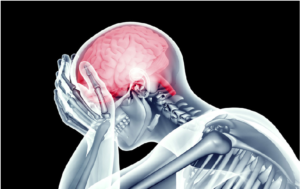 Neurological Physiotherapy Treatment