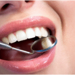 Modern Approaches to Achieving a Perfect Smile