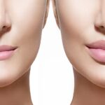 Why Natural-Looking Enhancements Are Changing the Conversation Around Beauty